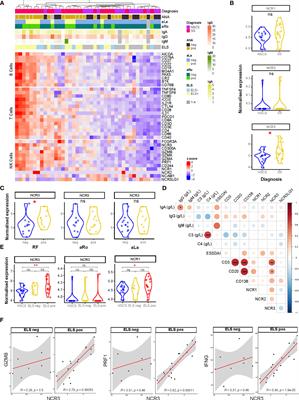 NKp30 Receptor Upregulation in Salivary Glands of Sjögren’s Syndrome Characterizes Ectopic Lymphoid Structures and Is Restricted by Rituximab Treatment